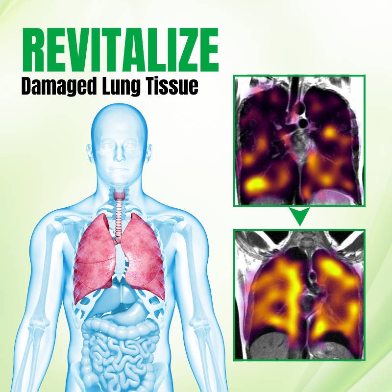 Biancat™ RespiPure Herbal Lung Detox Spray👍