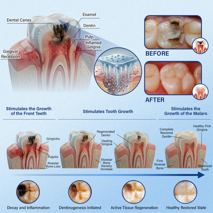 Ceoerty® Tooth & Gum Repair Fast-Dissolving Microneedle Patch